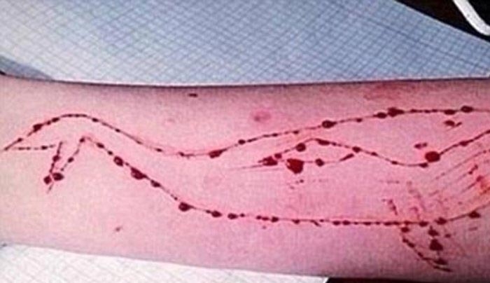 Προειδοποίηση της ΕΛΑΣ στους γονείς για το θανατηφόρο «παιχνίδι» της «μπλε φάλαινας»