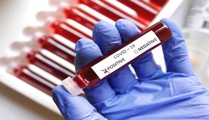 Κορωνοϊός – 23.340 νέα κρούσματα και 106 θάνατοι – Στους 673 οι διασωληνωμένοι