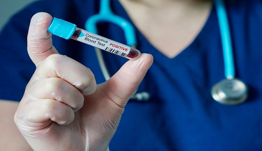 Μεγάλη διασπορά στα νέα κρούσματα-Δύο στη Ρόδο