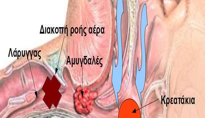Τα "Κρεατάκια" βασική αιτία κακής αναπνοής στα παιδιά!