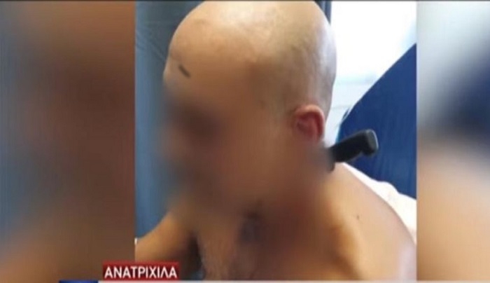 Σοκ στην Καλαμάτα: Κάρφωσε το μαχαίρι στο λαιμό του κουμπάρου της [βίντεο]