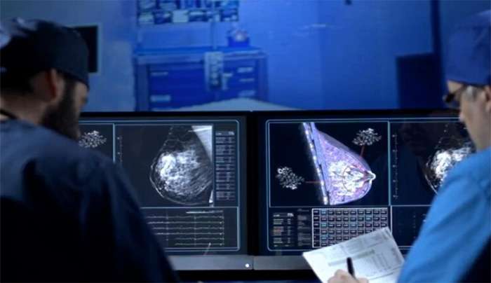 Μία στις 20 γυναίκες παγκοσμίως διαγιγνώσκεται με καρκίνο του μαστού