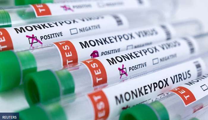 Ευλογιά των πιθήκων: Συνολικά 12 τα κρούσματα στη χώρα - Τα συμπτώματα και μετά από πόσες μέρες εμφανίζονται