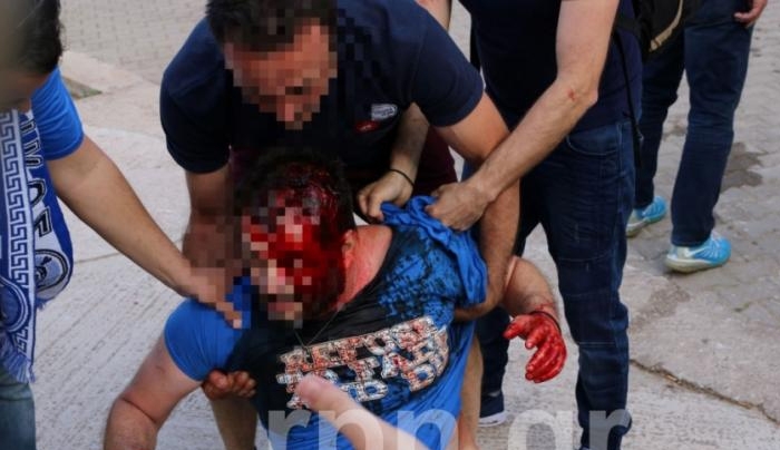 Μόνο ντροπή και οργή! Άνοιξαν κεφάλια σε αγώνα Γ’ Εθνικής στα Σπάτα [pics, vid]