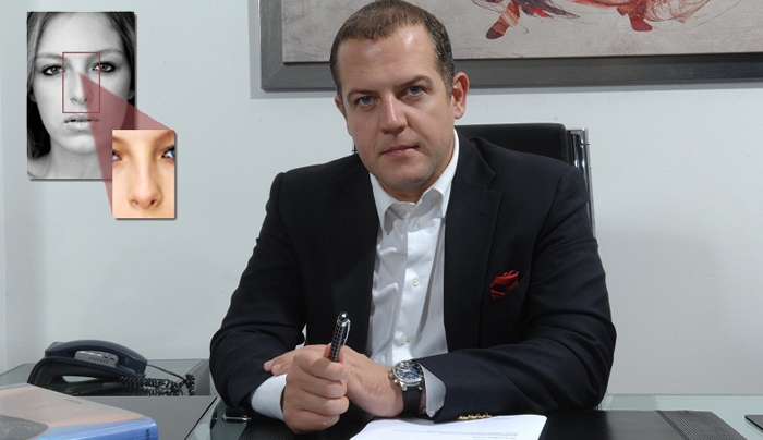 Ανοιχτή ρινοπλαστική συνδυάζει το τερπνόν μετά του ωφέλιμου