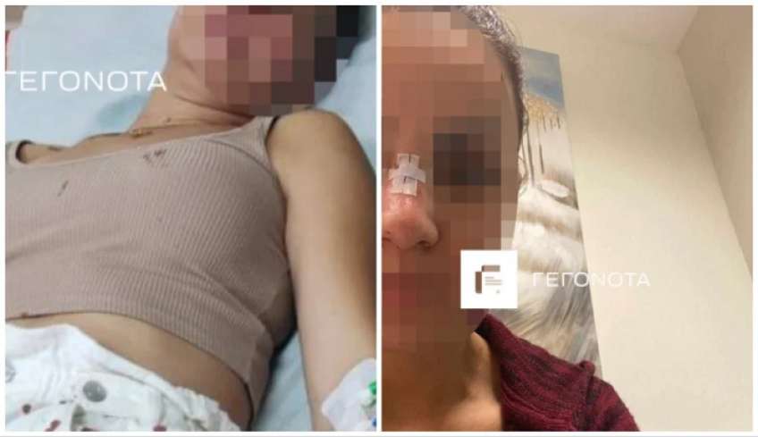 Βόλος: Διεθνής αθλητής χτύπησε την πρώην σύζυγό του μπροστά στο παιδί τους -Σοκάρουν οι φωτογραφίες